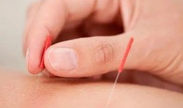 《针》 在线观看,揭秘针疗的神奇疗效与独特魅力